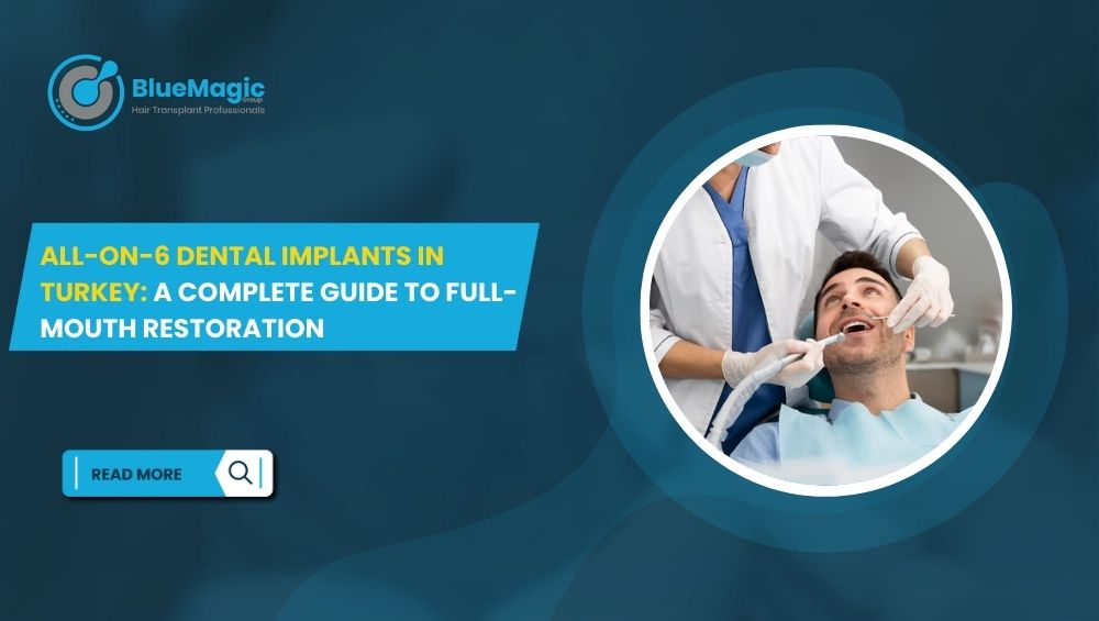 All-on-6 Dental Implants in Turkey: A Complete Guide to Full-Mouth Restoration