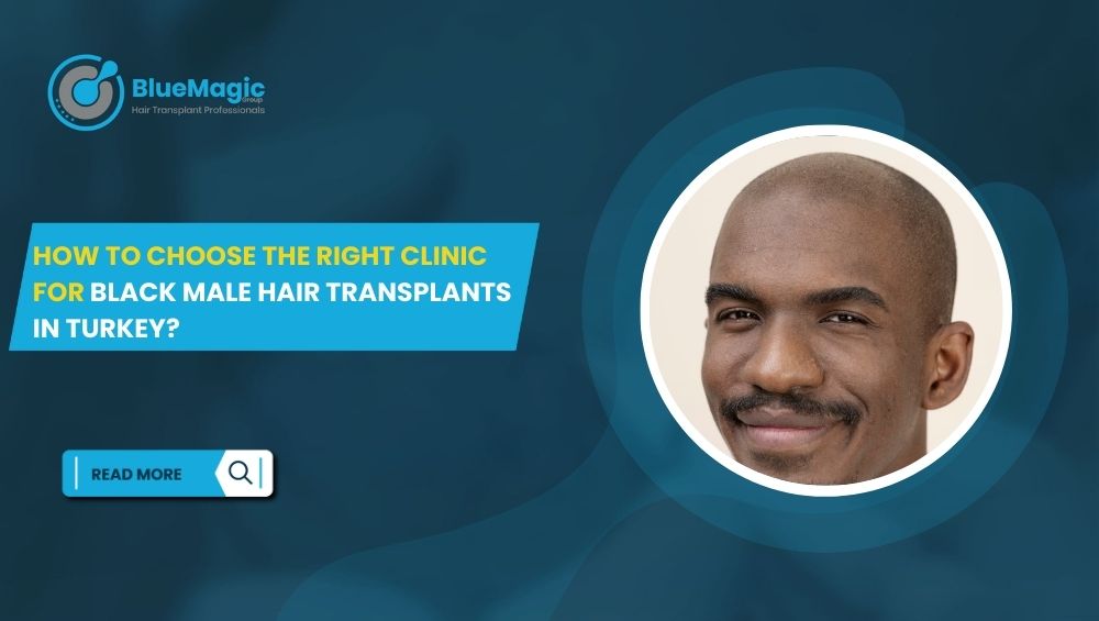 How to Choose the Right Clinic for Black Male Hair Transplants in Turkey