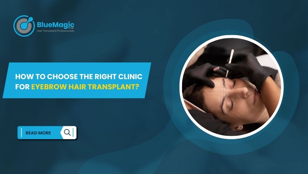 How to Choose the Right Clinic for Eyebrow Hair Transplant