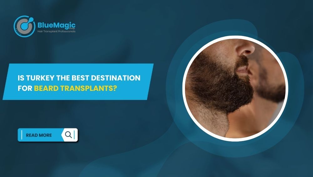 Is Turkey the Best Destination for Beard Transplants