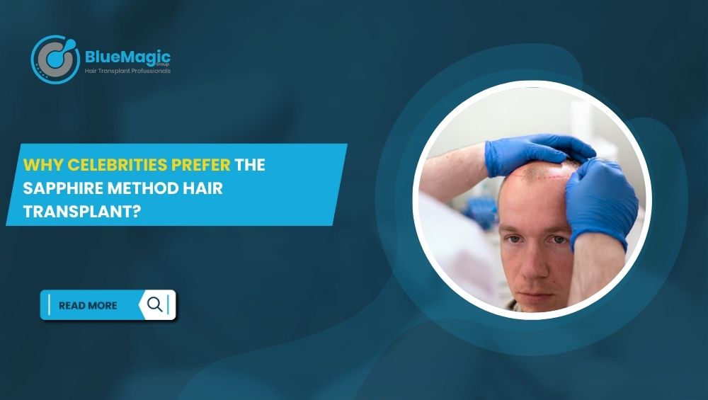 Why Celebrities Prefer the Sapphire Method Hair Transplant