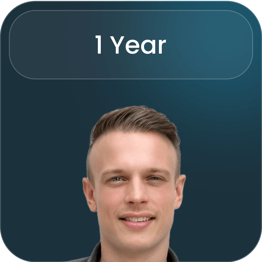 Final step in the hair transplantation process at BlueMagic Group, focusing on long-term maintenance and hair growth monitoring