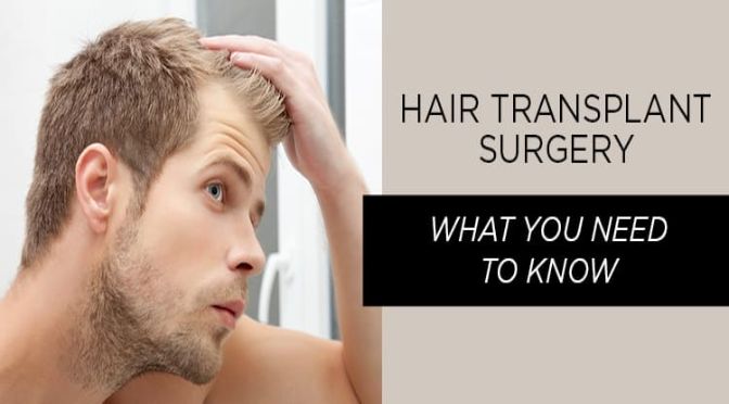 Loosing Hair? Know about Hair Transplant!