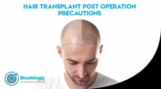 Hair Transplant: Post Operation Precautions