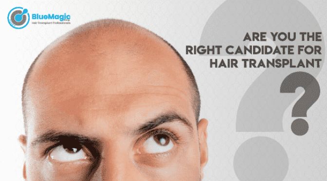 Discover If Hair Transplant Surgery is Right for You: A Guide for the best Hair Transplant Candidate