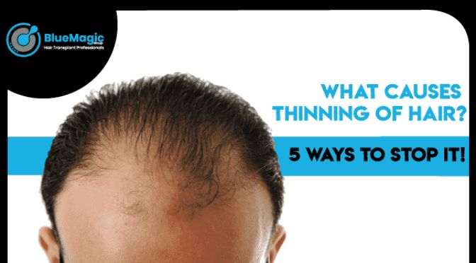 Causes of Hair Thinning: 5 Ways To Stop It!