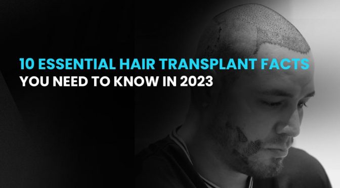 10 Essential Hair Transplant Facts You Need to Know in 2023