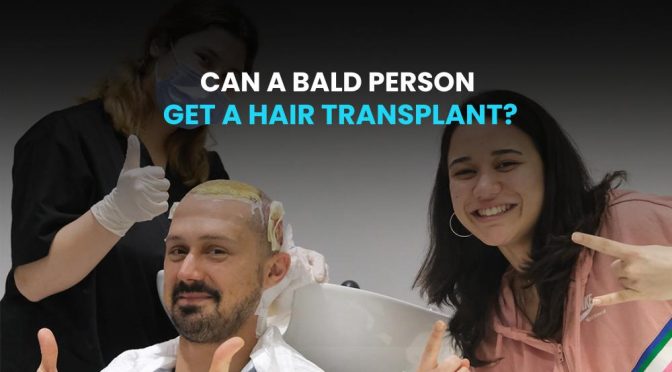 Can a Bald Person Get A Hair Transplant