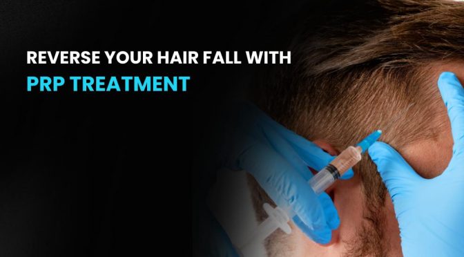 Reverse Your Hair Fall With PRP Treatment