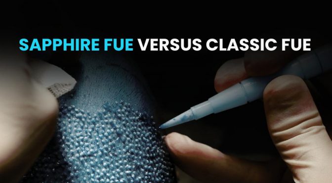 Sapphire FUE versus Classic FUE