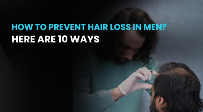 How to prevent hair loss in men? Here are 10 Ways