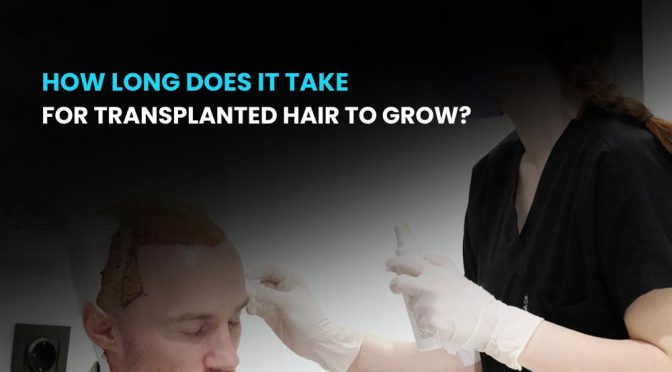 How Long Does It Take for Transplanted Hair to Grow?