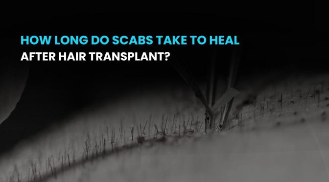 How long do scabs take to heal after hair transplant
