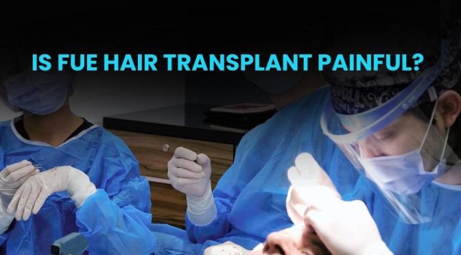 Is FUE Hair Transplant Painful?