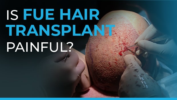 Is FUE Hair Transplant Painful?
