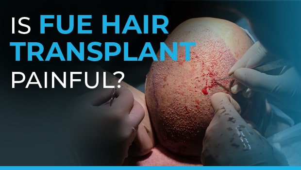 Is FUE Hair Transplant Painful? Is FUE Hair Transplant Painful?