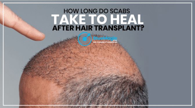 How long do scabs take to heal after hair transplant?