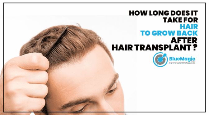 How Long Does It Take for Transplanted Hair to Grow? How Long Does It Take for Transplanted Hair to Grow?