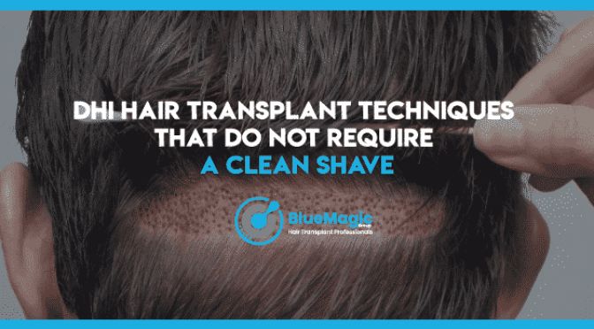 DHI Hair Transplant Techniques That Don't Require A Clean Shave DHI Hair Transplant Techniques That Don't Require A Clean Shave