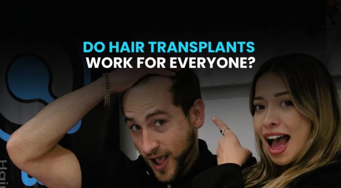 Do hair transplants work for everyone?
