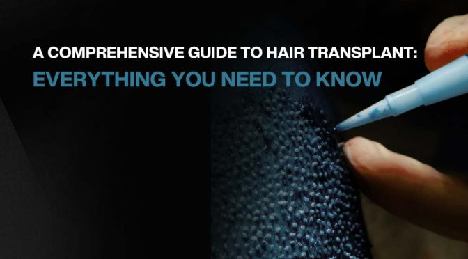 A Comprehensive Guide to Hair Transplant: Everything You Need to Know