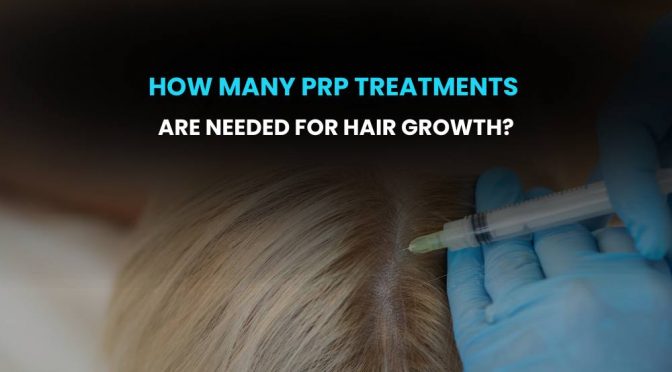How Many PRP Treatments Are Needed For Hair Growth