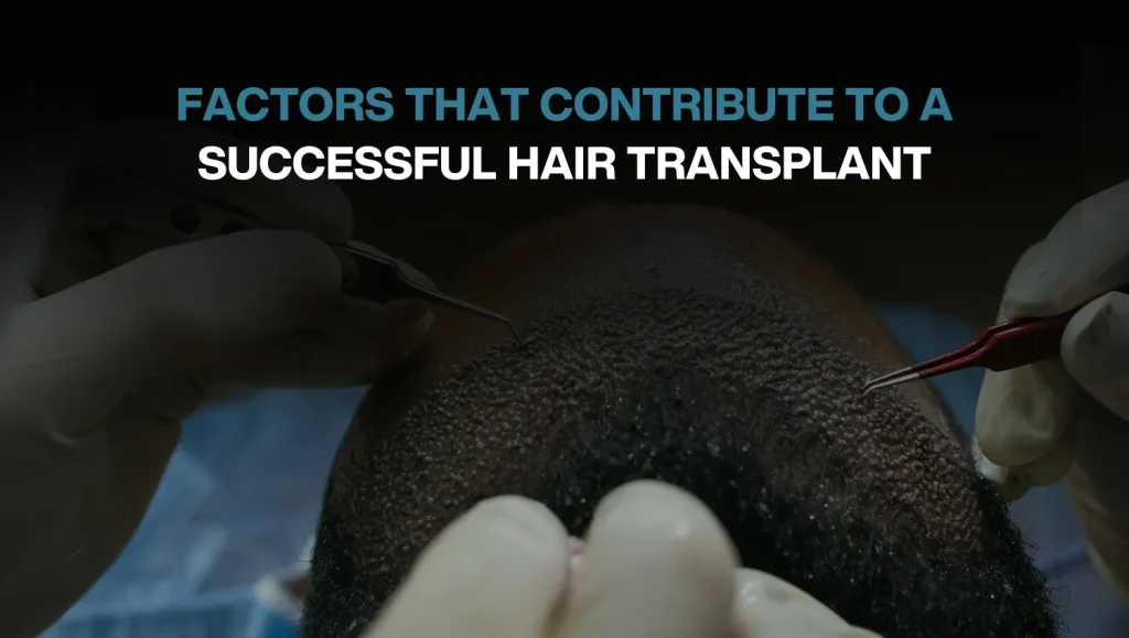 Hair transplant procedure at BlueMagic Clinic, highlighting precision grafting techniques for successful results.