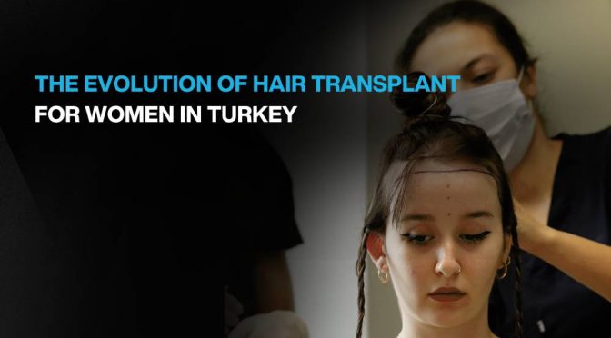 The Evolution Of Female Hair Transplant In Turkey