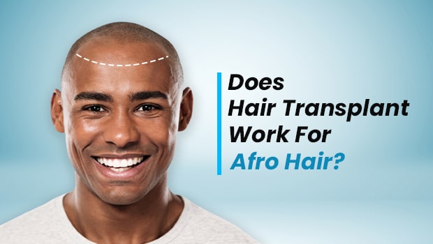 does hair replacement really work