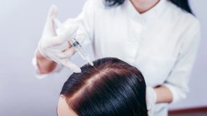 Success Rate Of Female Hair Transplant In Turkey