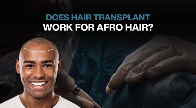 Does Hair Transplant Work For Afro Hair?