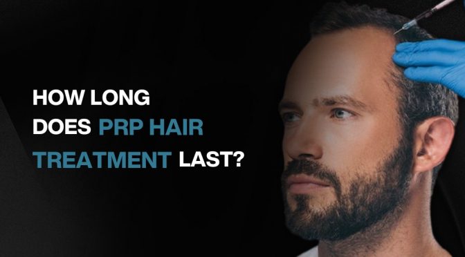 How Long Does PRP Hair Treatment Last?