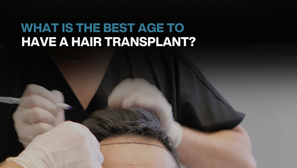 What Is The Best Age To Have A Hair Transplant? | BlueMagic Group