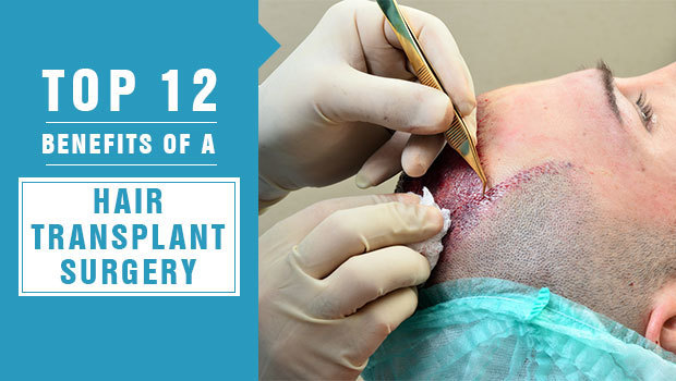 Top 12 Benefits Of A Hair Transplant Surgery