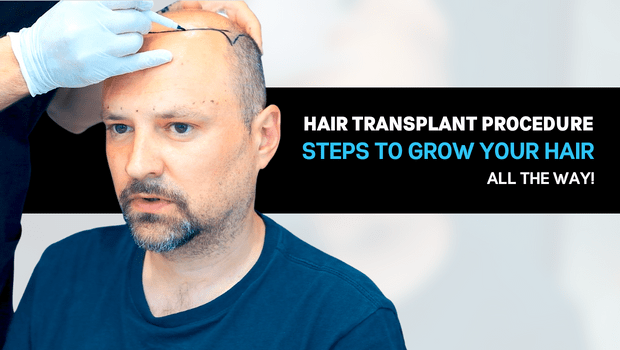 How is a Hair Transplant Procedure Performed?