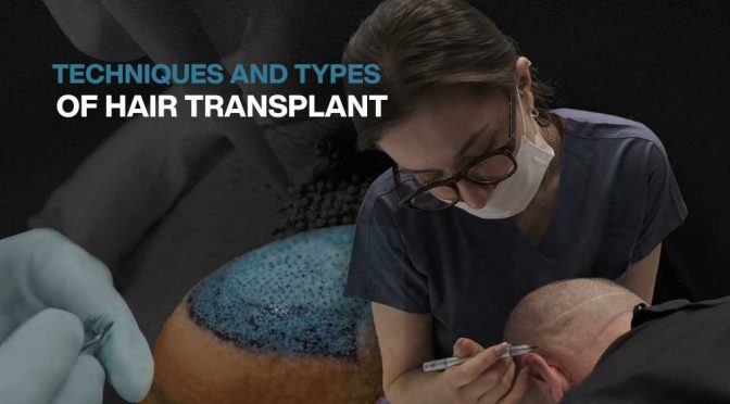 Hair transplant for Women 2