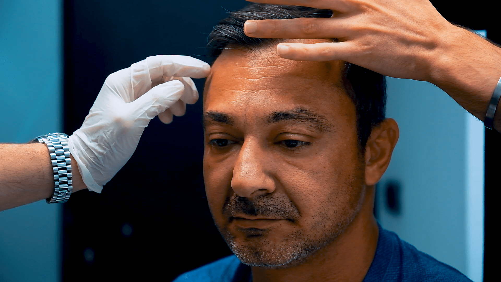 blue magic group hair transplant