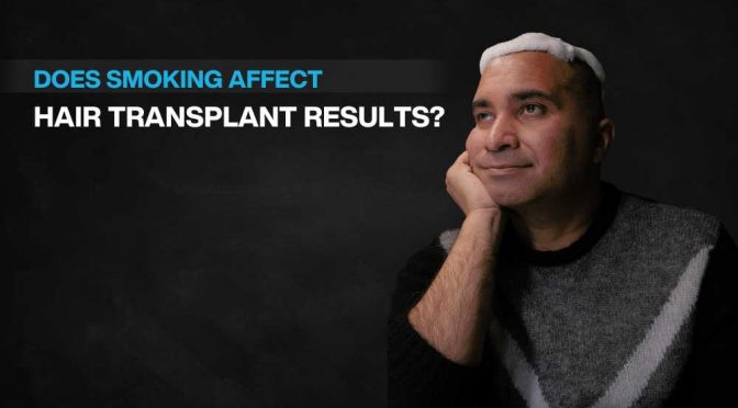 Copy of Hair transplant for Women 1