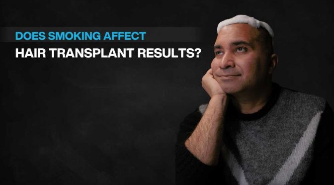 Does Smoking Affect Hair Transplant Results?