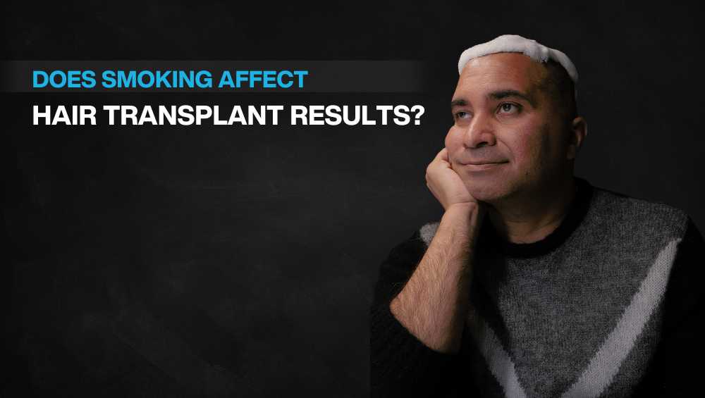 Copy of Hair transplant for Women 1