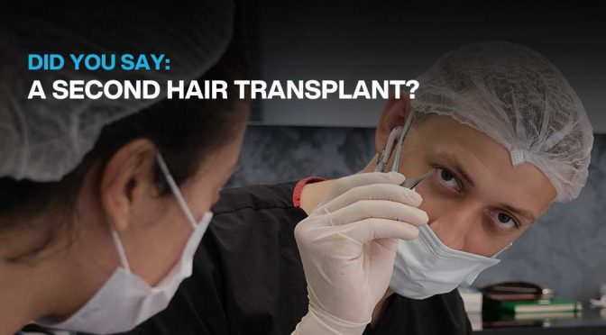 When Can You Have A Second Hair Transplant?