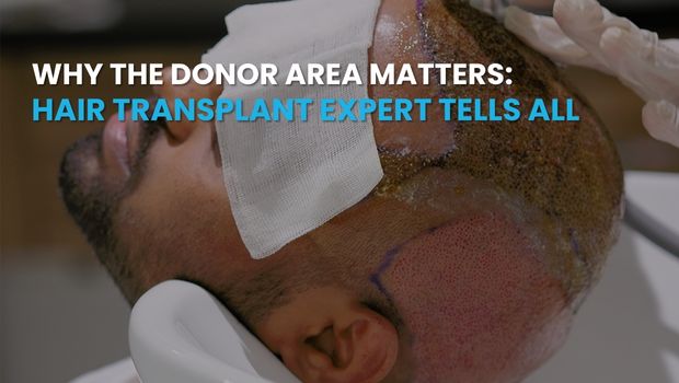 Why the Donor Area Matters Hair Transplant Expert Tells All