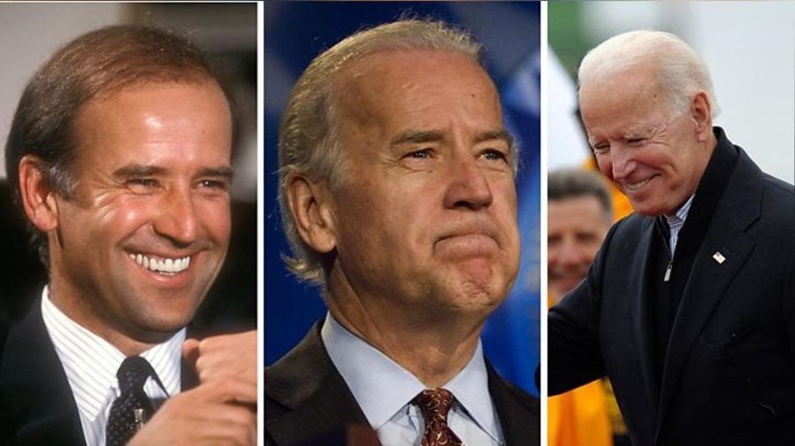 joe-biden forehead reduction