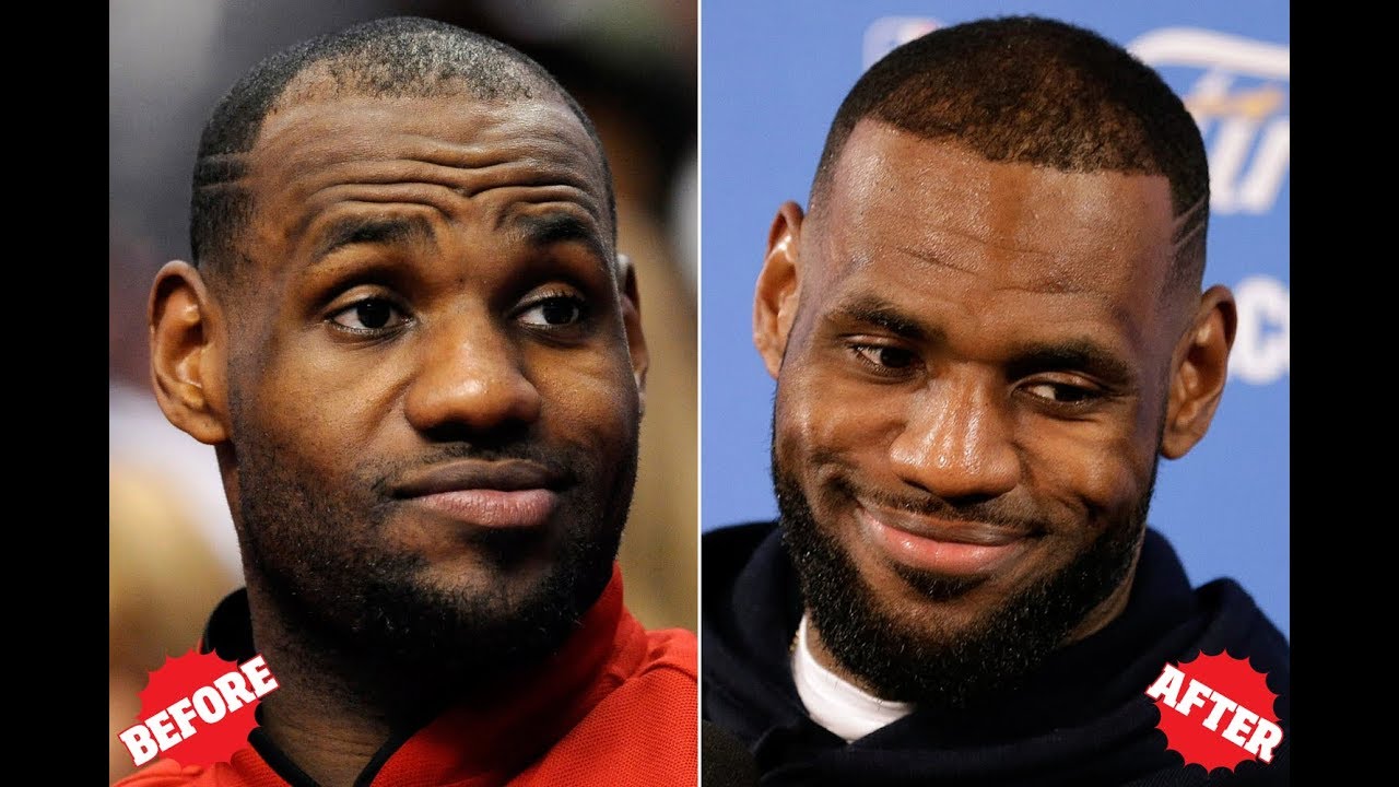 lebron james before and after