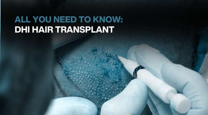 8000 grafts hair transplant