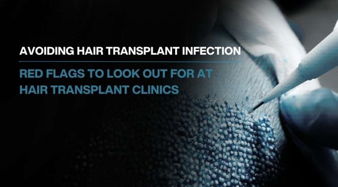 Avoiding Hair Transplant Infection: Red Flags to Look Out for at Hair Transplant Clinics