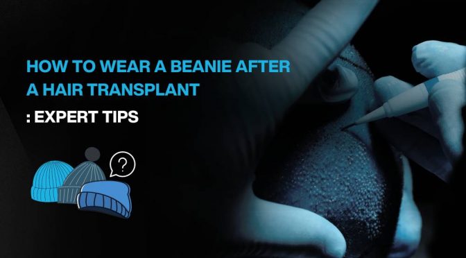 Copy of Hair transplant for Women 3