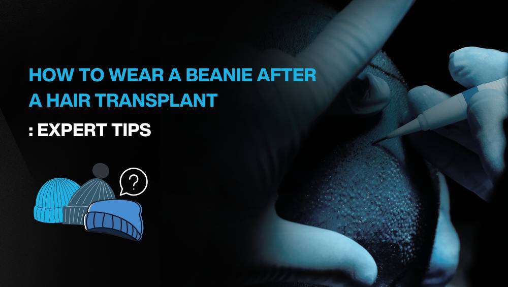 Copy of Hair transplant for Women 3