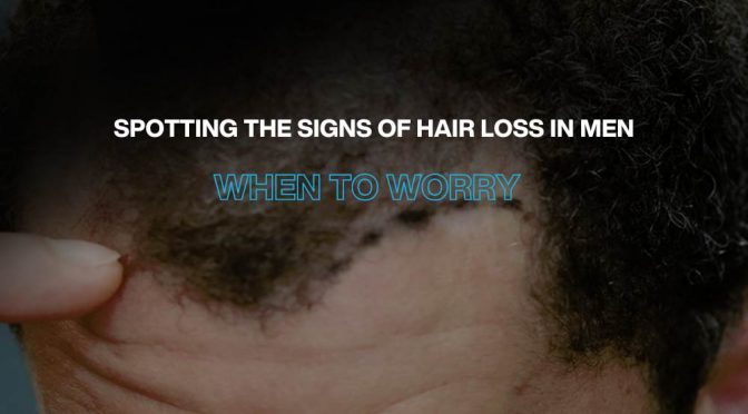 Spotting the Signs of Hair Loss in Men: When you need to worry!