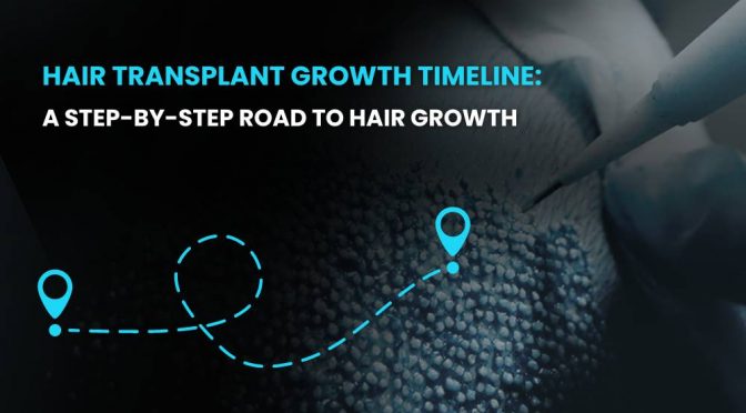 Hair Transplant Growth Timeline: A Step-by-Step Road to Hair Growth